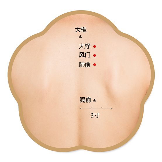 大椎、大杼、风门、肺俞、膈俞