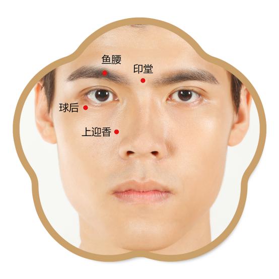 鱼腰、印堂、球后、上迎香