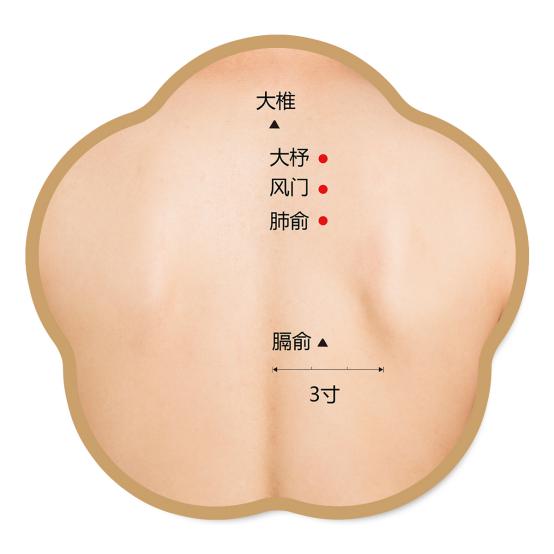 大椎、大杼、风门、肺俞、膈俞