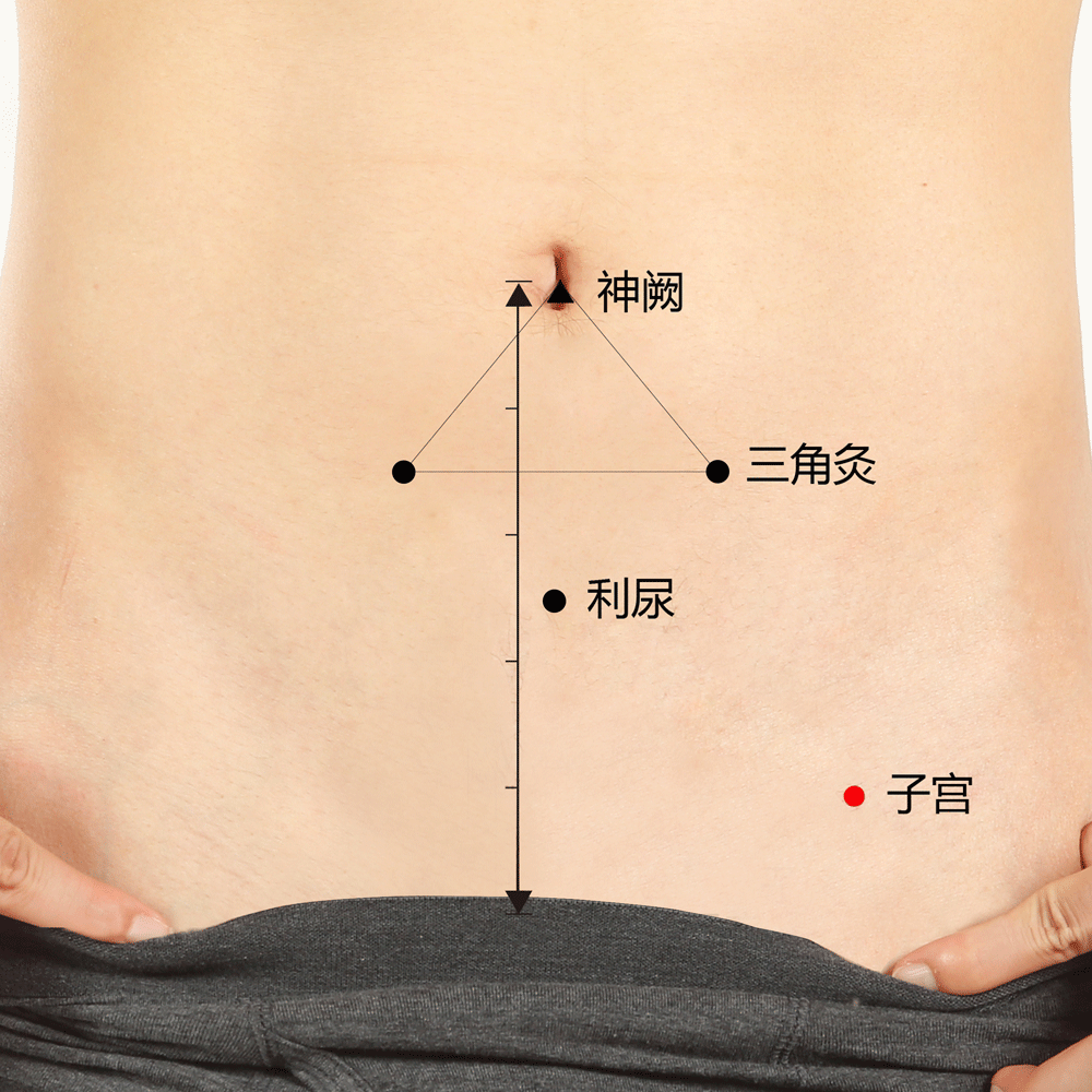 艾艾贴穴位·子宫穴：女性福利穴，调理各种妇科疾病！